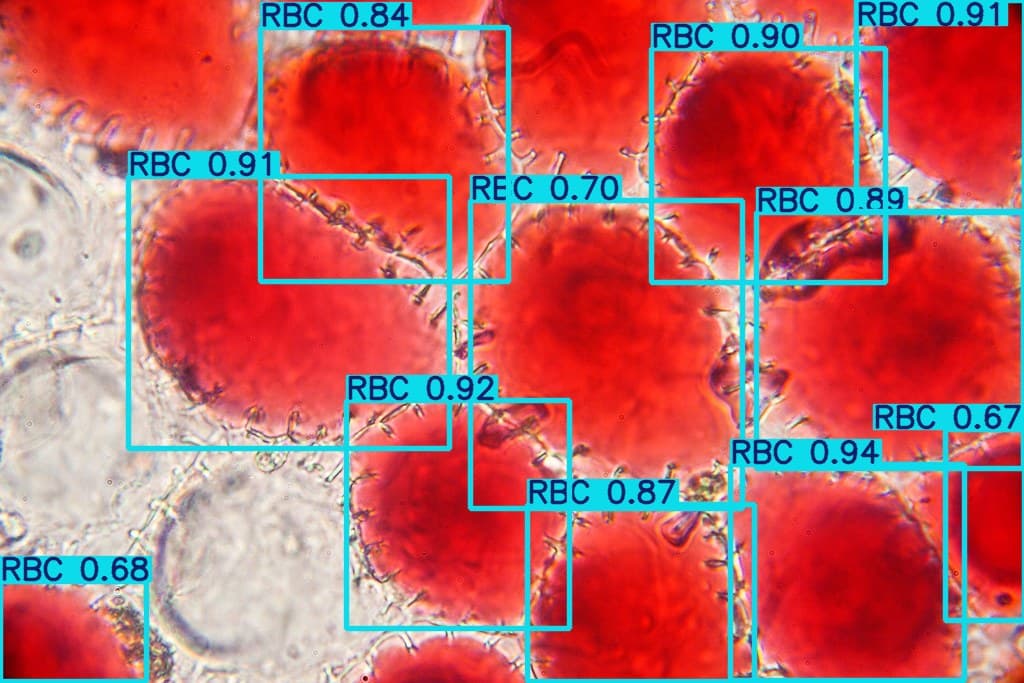 blood-cell-detector-yolo-ds1-640