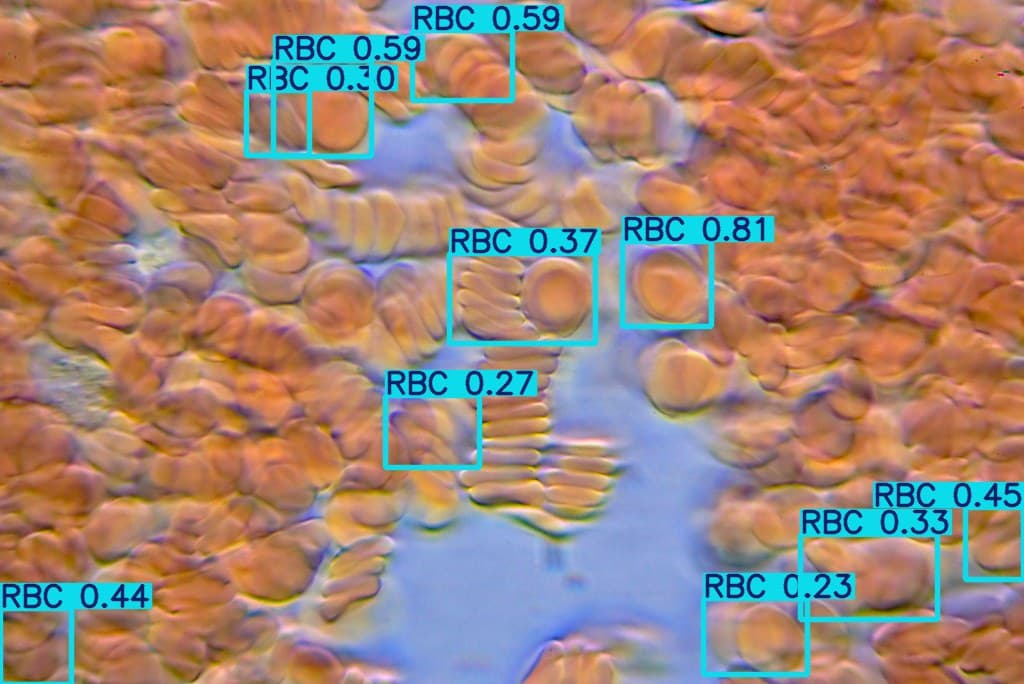blood-cell-detector-yolo-ds1-320